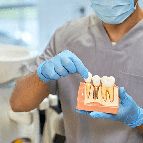 dental implants puyallup