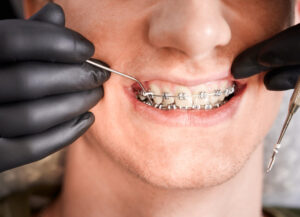 Orthodontic Treatment: Key Facts & Tips for First-Time Patients