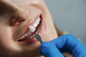 Latest Trends in Cosmetic Dentistry: Unlock a Beautiful Smile