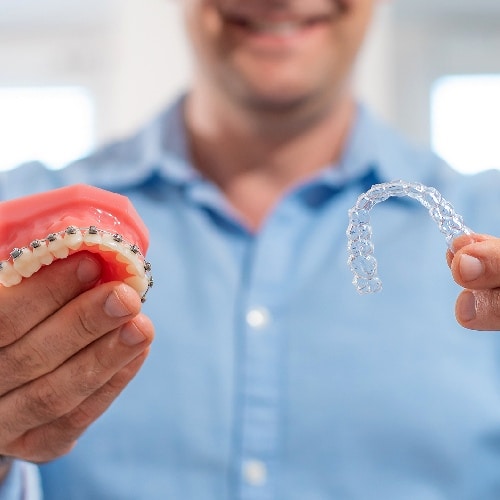 About Clear Aligners