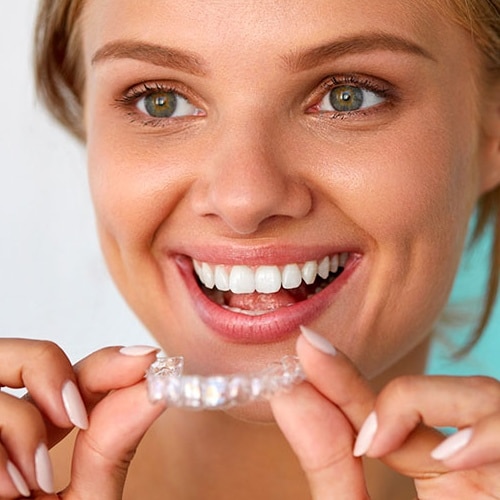 Clear Aligner Treatment